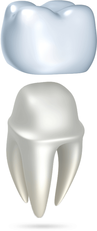 dental porcelain crown model