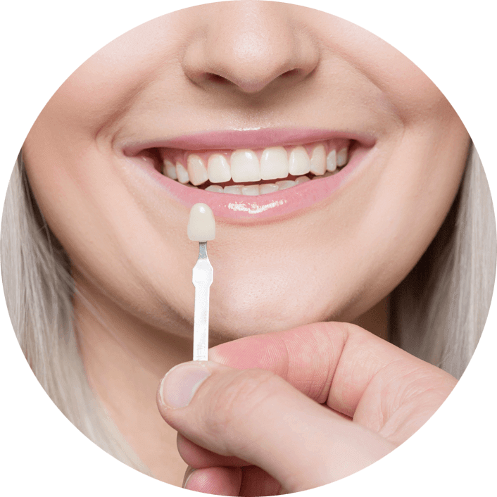 dental veneers patient smiling