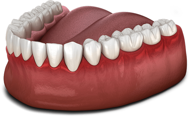 gum disease graphic