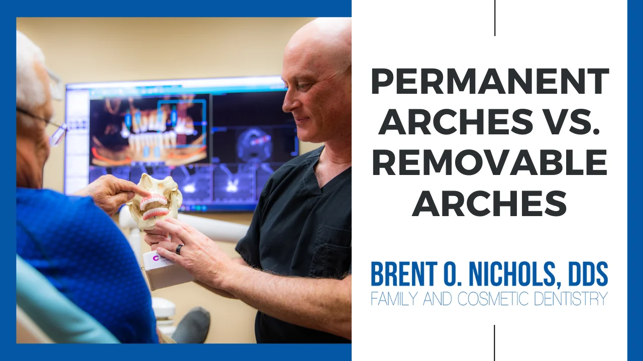 Permanent Arches vs Removable Arches Video Card